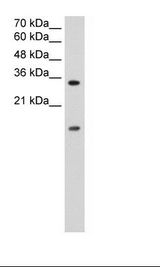 Jurkat Cell Lysate
