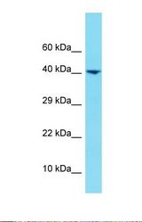 Western blot of Human COLO205. HNRNPUL1 antibody dilution 1.0 ug/ml.