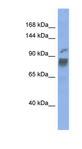 HNRNPUL1 / HNRPUL1 antibody LS-C110556 Western blot of ACHN lysate.