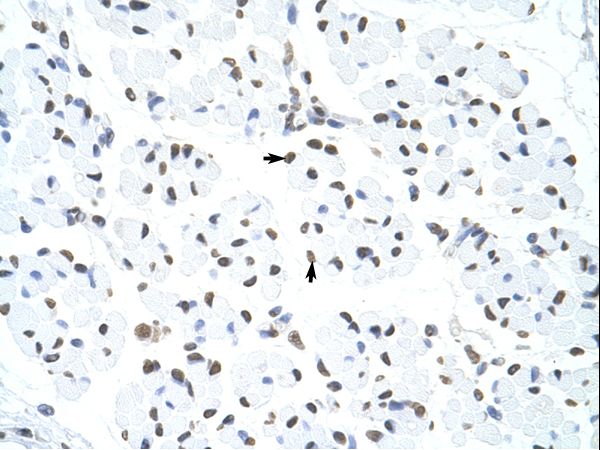 HNRNPUL1 / HNRPUL1 antibody LS-C31736 was used in IHC to stain formalin-fixed, paraffin-embedded human muscle.