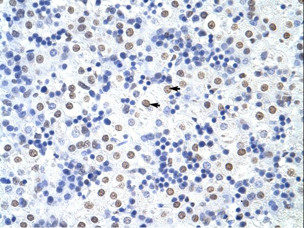 HNRNPUL1 / HNRPUL1 antibody LS-C31736 was used in IHC to stain formalin-fixed, paraffin-embedded human liver.