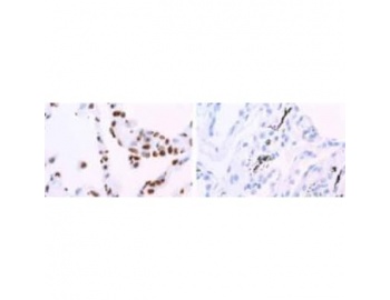 Immunohistochemistry (Formalin/PFA-fixed paraffin-embedded sections)-hnRNP A1 antibody [9H10] staining human lung. Staining is localized to the nucleus.
