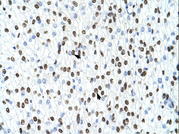 HNRNPA1 / HnRNP A1 antibody LS-C31557 was used in IHC to stain formalin-fixed, paraffin-embedded human heart.