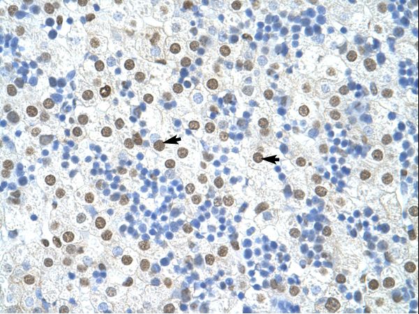 HNRNPA1 / HnRNP A1 antibody LS-C31557 was used in IHC to stain formalin-fixed, paraffin-embedded human liver.