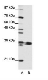 A: Marker, B: Jurkat Cell Lysate