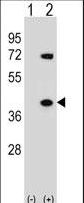 Western blot of HNRNPA1 (arrow) using rabbit polyclonal HNRNPA1 Antibody. 293 cell lysates (2 ug/lane) either nontransfected (Lane 1) or transiently transfected (Lane 2) with the HNRNPA1 gene.