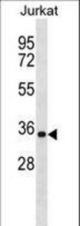 HNRNPA1 Antibody western blot of Jurkat cell line lysates (35 ug/lane). The HNRNPA1 antibody detected the HNRNPA1 protein (arrow).