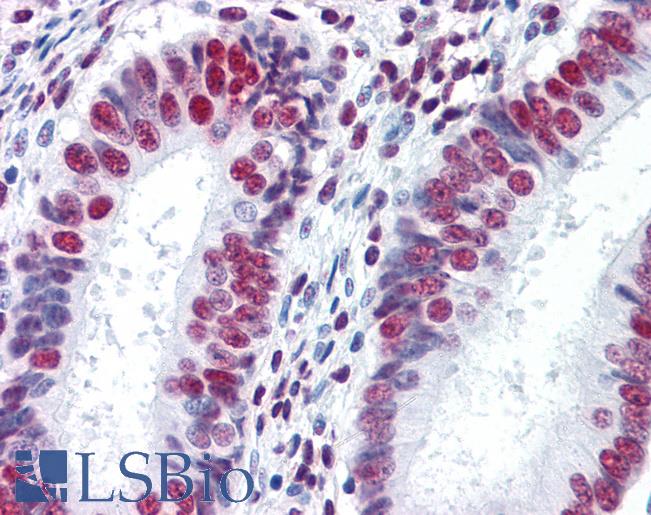 Anti-HNRNPM / HNRPM antibody IHC of human uterus. Immunohistochemistry of formalin-fixed, paraffin-embedded tissue after heat-induced antigen retrieval. Antibody LS-B4384 concentration 5 ug/ml.