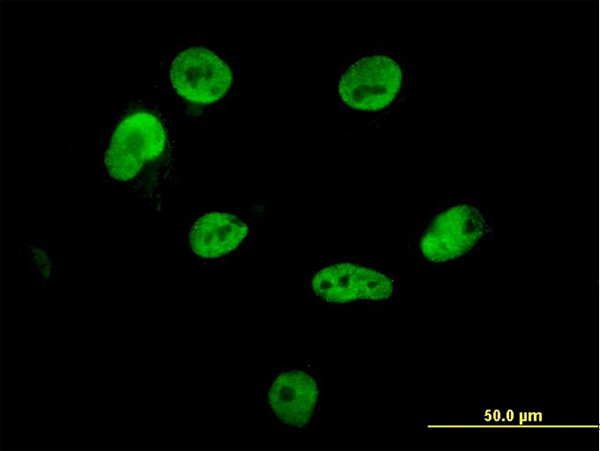Immunofluorescence of monoclonal antibody to HNRPM on HepG2 cell (antibody concentration 10 ug/ml).