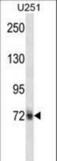 HNRNPM Antibody western blot of U251 cell line lysates (35 ug/lane). The HNRNPM antibody detected the HNRNPM protein (arrow).