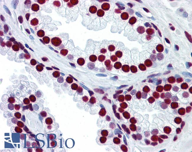 Anti-HNRNPM / HNRPM antibody IHC of human prostate. Immunohistochemistry of formalin-fixed, paraffin-embedded tissue after heat-induced antigen retrieval. Antibody LS-B5711 concentration 5 ug/ml.