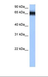 Jurkat cell lysate. Antibody concentration: 0.5 ug/ml. Gel concentration: 12%.