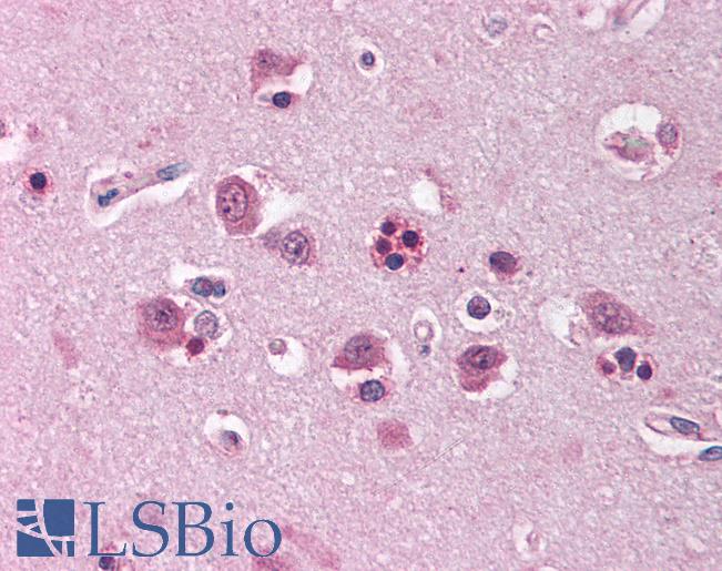 Anti-HOMER1 / Homer antibody IHC of human brain, cortex. Immunohistochemistry of formalin-fixed, paraffin-embedded tissue after heat-induced antigen retrieval. Antibody LS-B1538 concentration 5 ug/ml.