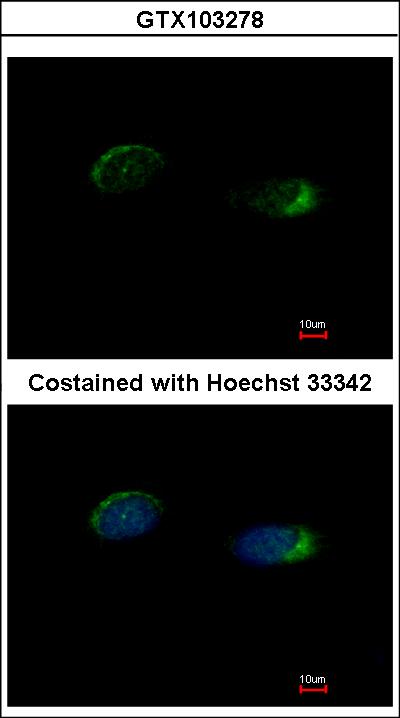 Immunofluorescence of methanol-fixed HeLa using Homer antibody at 1:500 dilution.