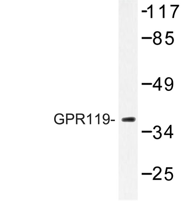 Western blot of GPR119 (V227) pAb in extracts from K562 cells.