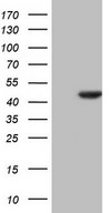 HEK293T cells were transfected with the pCMV6-ENTRY control (Left lane) or pCMV6-ENTRY HOMER2 (Right lane) cDNA for 48 hrs and lysed. Equivalent amounts of cell lysates (5 ug per lane) were separated by SDS-PAGE and immunoblotted with anti-HOMER2.