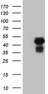 HEK293T cells were transfected with the pCMV6-ENTRY control (Left lane) or pCMV6-ENTRY HOMER2 (Right lane) cDNA for 48 hrs and lysed. Equivalent amounts of cell lysates (5 ug per lane) were separated by SDS-PAGE and immunoblotted with anti-HOMER2.