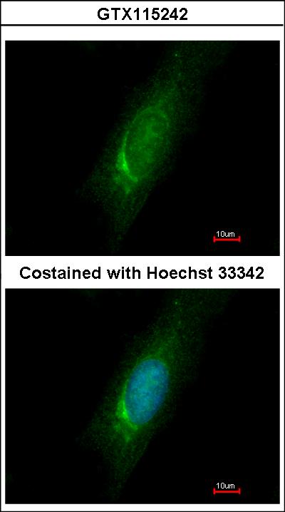Immunofluorescence of methanol-fixed HeLa using Homer3 antibody at 1:500 dilution.