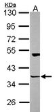 Sample (30 ug of whole cell lysate). A: NT2D1. 10% SDS PAGE. HOMER3 antibody diluted at 1:1000.