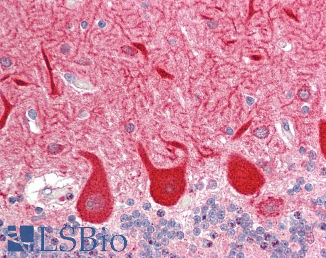 Human Brain, Cerebellum: Formalin-Fixed, Paraffin-Embedded (FFPE)