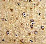 Formalin-fixed and paraffin-embedded human brain tissue with HOMER3 Antibody , which was peroxidase-conjugated to the secondary antibody, followed by DAB staining. This data demonstrates the use of this antibody for immunohistochemistry; clinical relevance has not been evaluated.