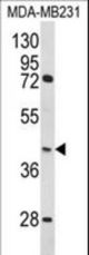 Western blot of HOMER3 Antibody in MDA-MB231 cell line lysates (35 ug/lane). HOMER3 (arrow) was detected using the purified antibody.