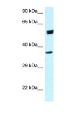 HOMER3 antibody LS-C145733 Western blot of HeLa Cell lysate. Antibody concentration 1 ug/ml.