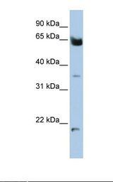 721_B cell lysate. Antibody concentration: 1.0 ug/ml. Gel concentration: 12%.