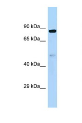 HOOK1 antibody LS-C145357 Western blot of Fetal Heart lysate. Antibody concentration 1 ug/ml.