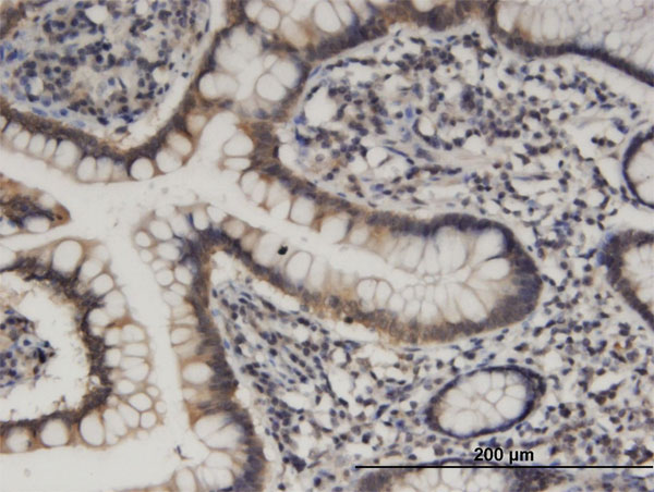 Immunoperoxidase of monoclonal antibody to HOOK1 on formalin-fixed paraffin-embedded human small Intestine. [antibody concentration 3 ug/ml]