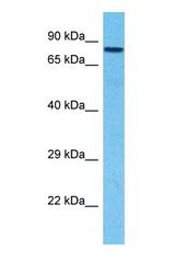 Western blot of HOOK2 Antibody with human Fetal Liver lysate.