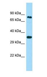 HOOK3 antibody Western Blot of Fetal Kidney.