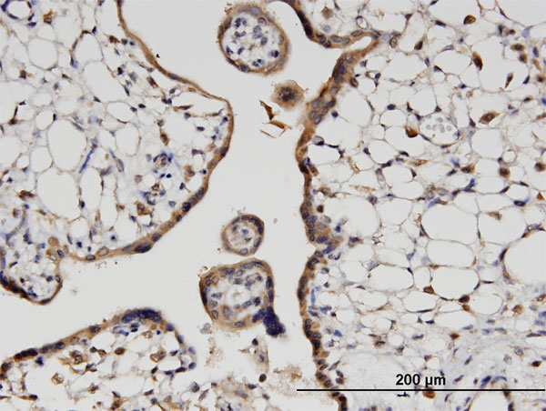 Immunoperoxidase of monoclonal antibody to HOOK3 on formalin-fixed paraffin-embedded human placenta. [antibody concentration 3 ug/ml]