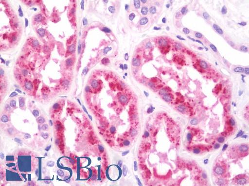 Anti-HOPX / HOP antibody IHC staining of human kidney. Immunohistochemistry of formalin-fixed, paraffin-embedded tissue after heat-induced antigen retrieval. Antibody LS-B10925 dilution 1:100.