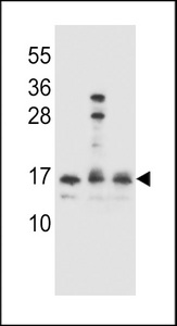 HOPX Antibody western blot of Ramos,A2058,293 cell line lysates (35 ug/lane). The HOPX antibody detected the HOPX protein (arrow).