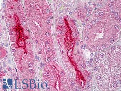 Anti-GPR119 antibody IHC of human kidney. Immunohistochemistry of formalin-fixed, paraffin-embedded tissue after heat-induced antigen retrieval. Antibody LS-B6791 concentration 5 ug/ml.