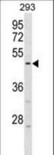 HORMAD1 Antibody western blot of 293 cell line lysates (35 ug/lane). The HORMAD1 antibody detected the HORMAD1 protein (arrow).
