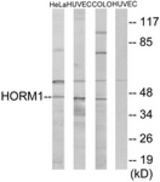 Western blot of extracts from HeLa/HUVEC/COLO cells, using HORMAD1 Antibody. The lane on the right is treated with the synthesized peptide.