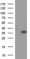 HEK293T cells were transfected with the pCMV6-ENTRY control (Left lane) or pCMV6-ENTRY HORMAD2 (Right lane) cDNA for 48 hrs and lysed. Equivalent amounts of cell lysates (5 ug per lane) were separated by SDS-PAGE and immunoblotted with anti-HORMAD2.