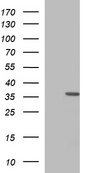 HEK293T cells were transfected with the pCMV6-ENTRY control (Left lane) or pCMV6-ENTRY HORMAD2 (Right lane) cDNA for 48 hrs and lysed. Equivalent amounts of cell lysates (5 ug per lane) were separated by SDS-PAGE and immunoblotted with anti-HORMAD2.