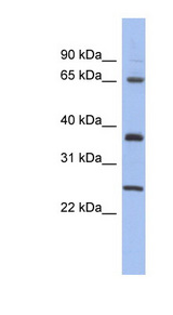 HORMAD2 antibody LS-C111459 Western blot of Placenta lysate.