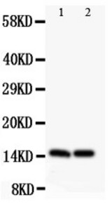 HOXA1 antibody Western blot. All lanes: Anti HOXA1 at 0.5 ug/ml. Lane 1: PC-12 Whole Cell Lysate at 40 ug. Lane 2: HELA Whole Cell Lysate at 40 ug. Predicted band size: 15 kD. Observed band size: 15 kD.