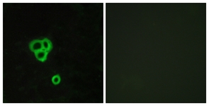 Immunofluorescence of MCF7 cells, using GPR119 Antibody. The picture on the right is treated with the synthesized peptide.