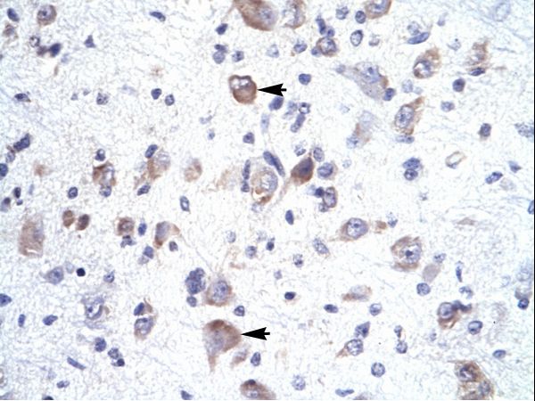 HOXA1 antibody LS-C30564 was used in IHC to stain formalin-fixed, paraffin-embedded human brain.