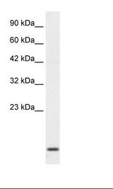 Jurkat Cell Lysate