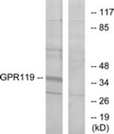 Western blot of extracts from K562 cells, using GPR119 Antibody. The lane on the right is treated with the synthesized peptide.