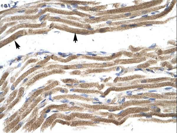 HOXA10 antibody LS-C30941 was used in IHC to stain formalin-fixed, paraffin-embedded human muscle.