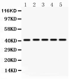 HOXA10 antibody Western blot. All lanes: Anti HOXA10 at 0.5 ug/ml. Lane 1: Rat Kidney Tissue Lysate at 50 ug. Lane 2: Human Placenta Tissue Lysate at 50 ug. Lane 3: HELA Whole Cell Lysate at 40 ug. Lane 4: SW620 Whole Cell Lysate at 40 ug. Lane 5: HEPA Whole Cell Lysate at 40 ug. Predicted band size: 41 kD. Observed band size: 41 kD.