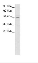Jurkat Cell Lysate