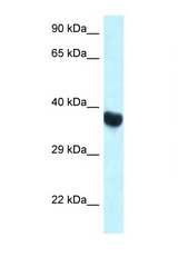 HOXA10 antibody LS-C145342 Western blot of Rat Muscle lysate. Antibody concentration 1 ug/ml.